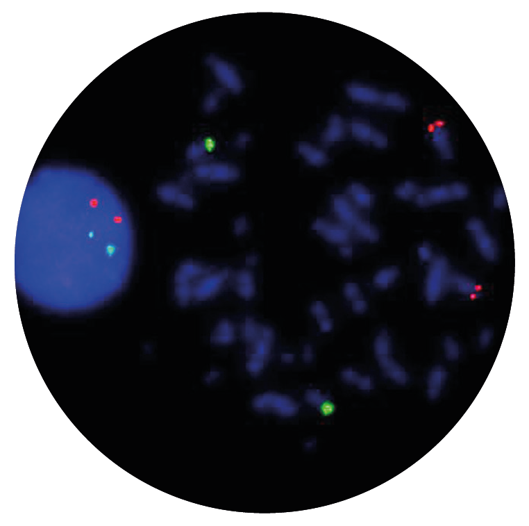 Fluorescence in situ hybridisation (FISH) microscope image of the CytoCell IGH/cMYC Plus Translocation, Dual Fusion probe.