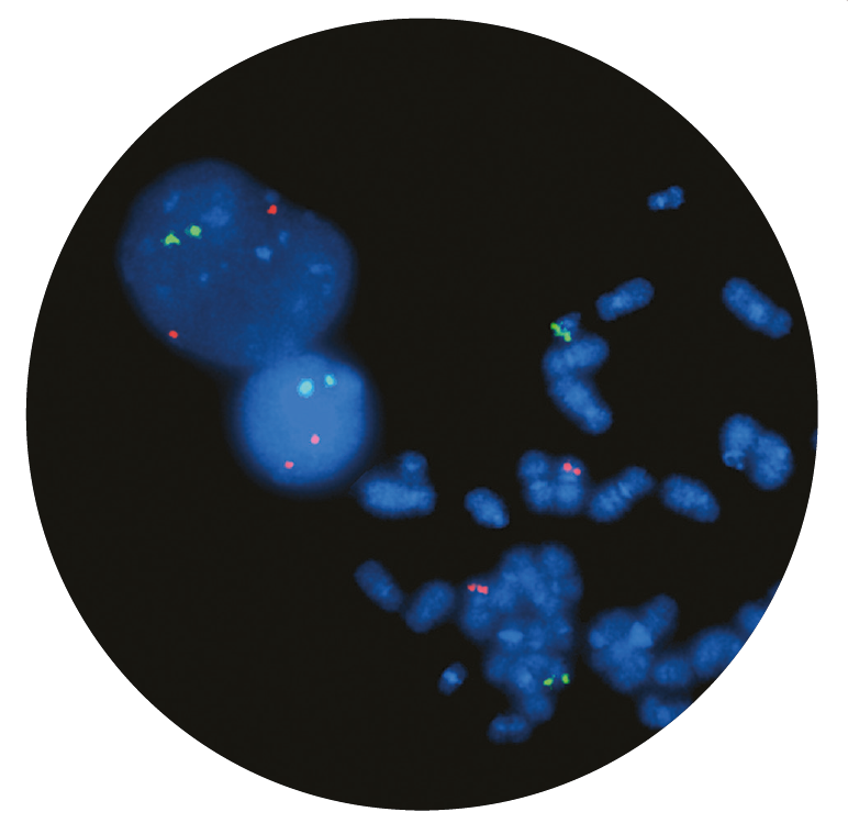 Fluorescence in situ hybridization (FISH) microscope image of the CytoCell TEL/AML1 Translocation, Dual Fusion probe.
