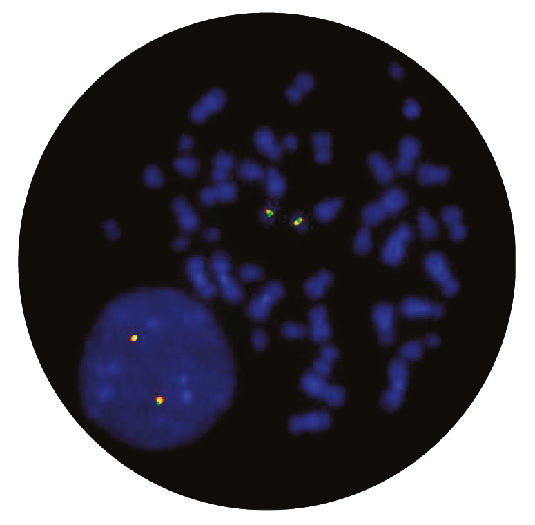 Fluorescence in situ hybridisation (FISH) microscope image of the CytoCell RARa (RARA) Breakapart probe.