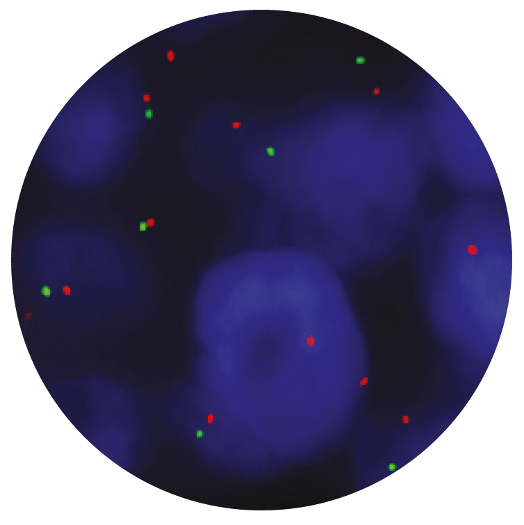 Fluorescence in situ hybridization (FISH) microscope image of the CytoCell RB1 Deletion probe.