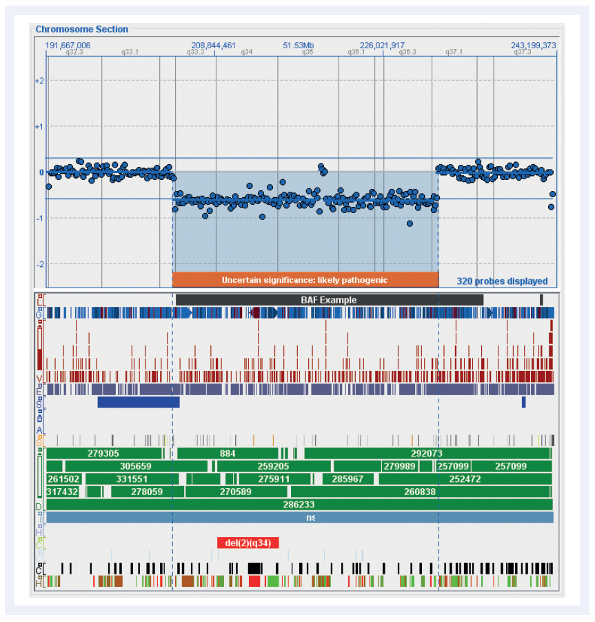 aCGH software data showing how fully customisable tracks in CytoSure Interpret Software simplify aberration interpretation.