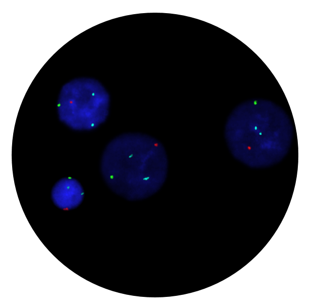 Fluorescence in situ hybridisation (FISH) microscope image of the CytoCell Prenatal X, Y and 18 probe.