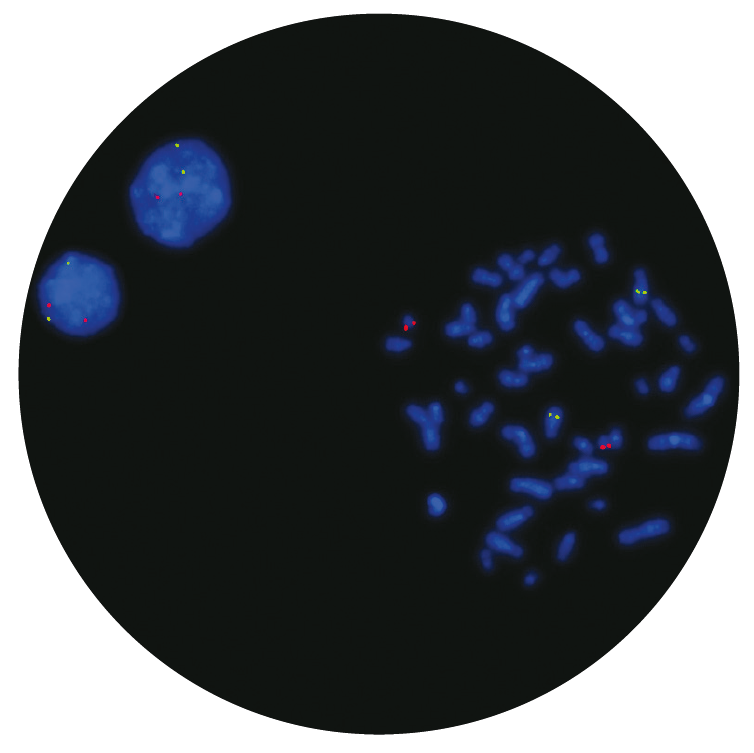 Fluorescence in situ hybridization (FISH) microscope image of the CytoCell AML1/ETO Translocation, Dual Fusion probe.