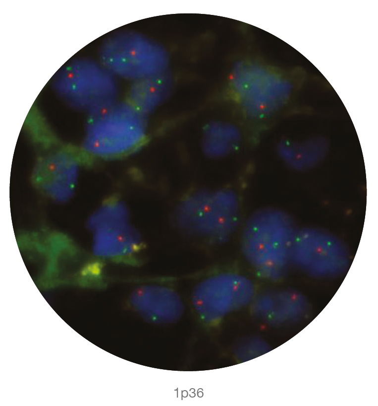 Fluorescence in situ hybridisation (FISH) microscope image of the CytoCell 1p36/1q25 Deletion probe.