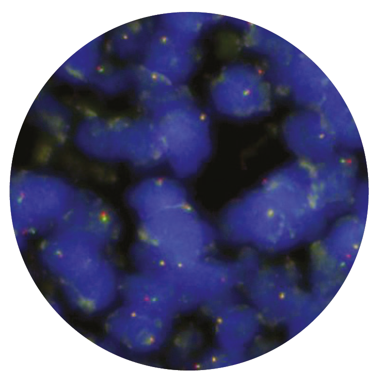 Fluorescence in situ hybridisation (FISH) microscope image of the CytoCell TFE3 Breakapart probe.