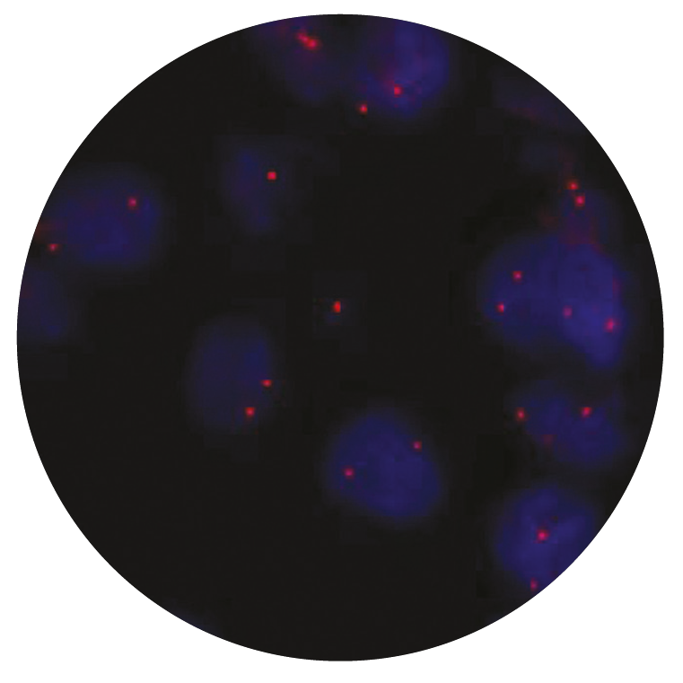 Fluorescence in situ hybridization (FISH) microscope image of the CytoCell ROS1-GOPC (FIG) Distal probe.