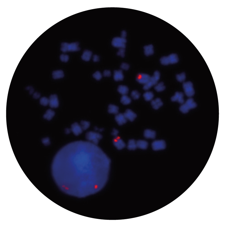 Fluorescence in situ hybridization (FISH) microscope image of the CytoCell CSF1R/RPS14 (5q32-q33) Probe Red.
