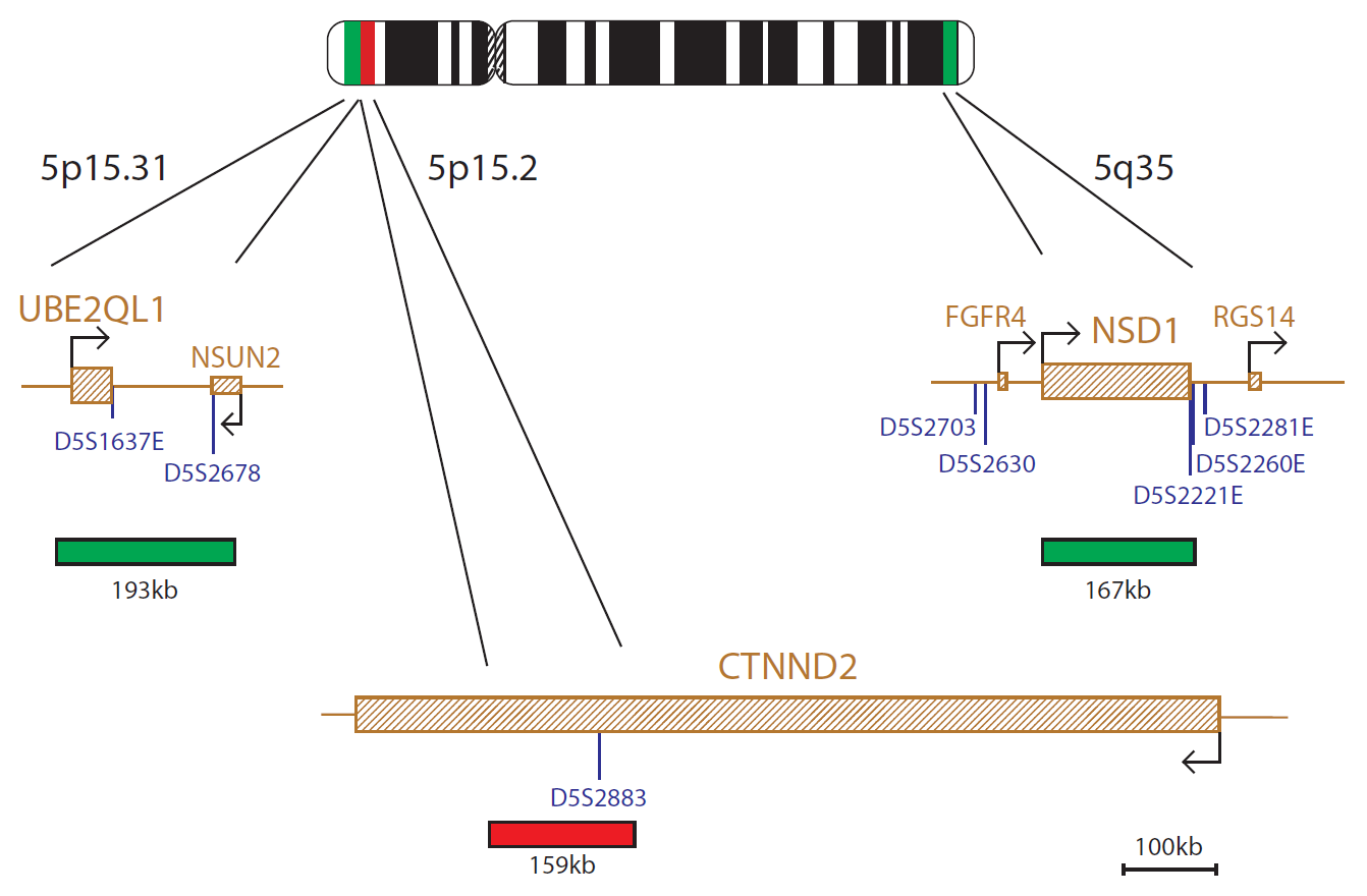 FISH chromosome map showing probes targeting regions associated with Cri-du-chat and SOTOS syndromes.