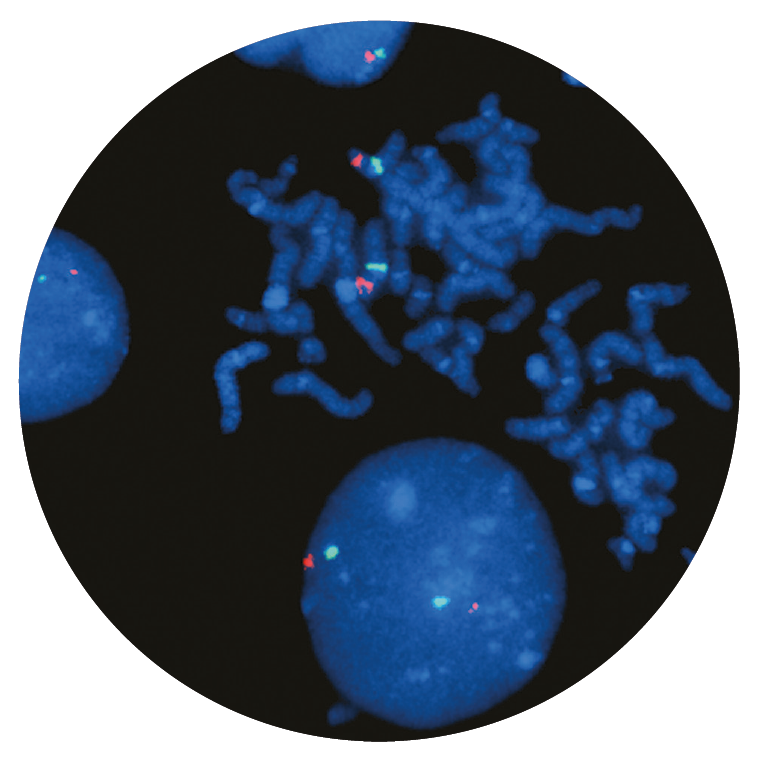 Fluorescence in situ hybridisation (FISH) microscope image of the CytoCell P16 (CDKN2A) Deletion probe.