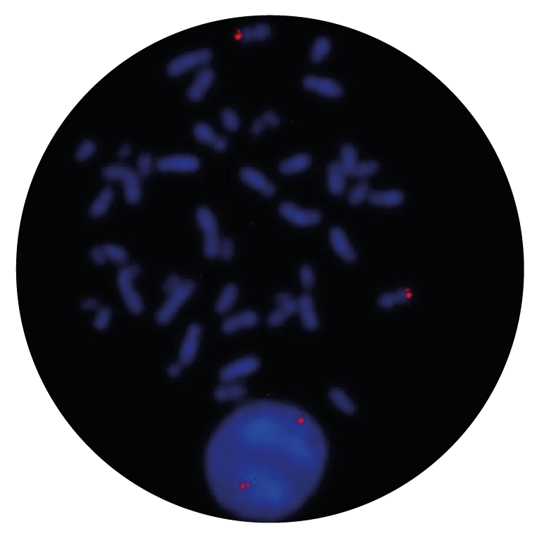 Fluorescence in situ hybridization (FISH) microscope image of the CytoCell NUP98 Proximal Probe Red.