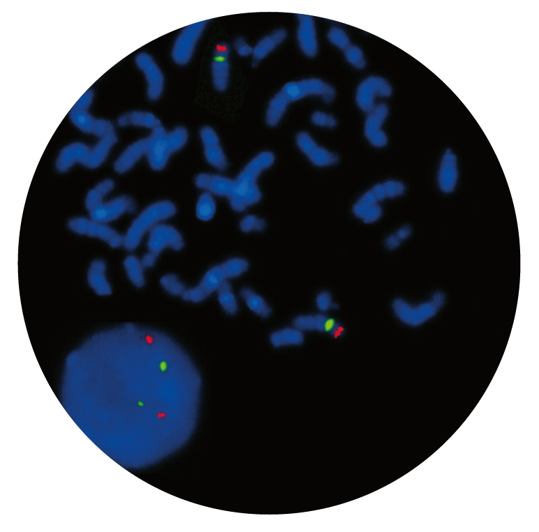 Fluorescence in situ hybridization (FISH) microscope image of the CytoCell DiGeorge II (10p14) probe.