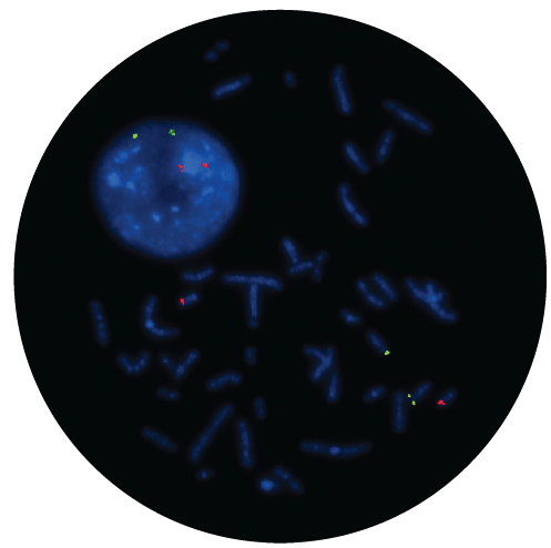 Fluorescence in situ hybridisation (FISH) microscope image of the CytoCell IGH/BCL2 Translocation, Dual Fusion probe.