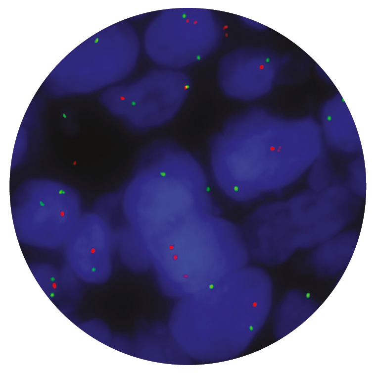Fluorescence in situ hybridisation (FISH) microscope image of the CytoCell SRD (CHD5) Deletion probe.