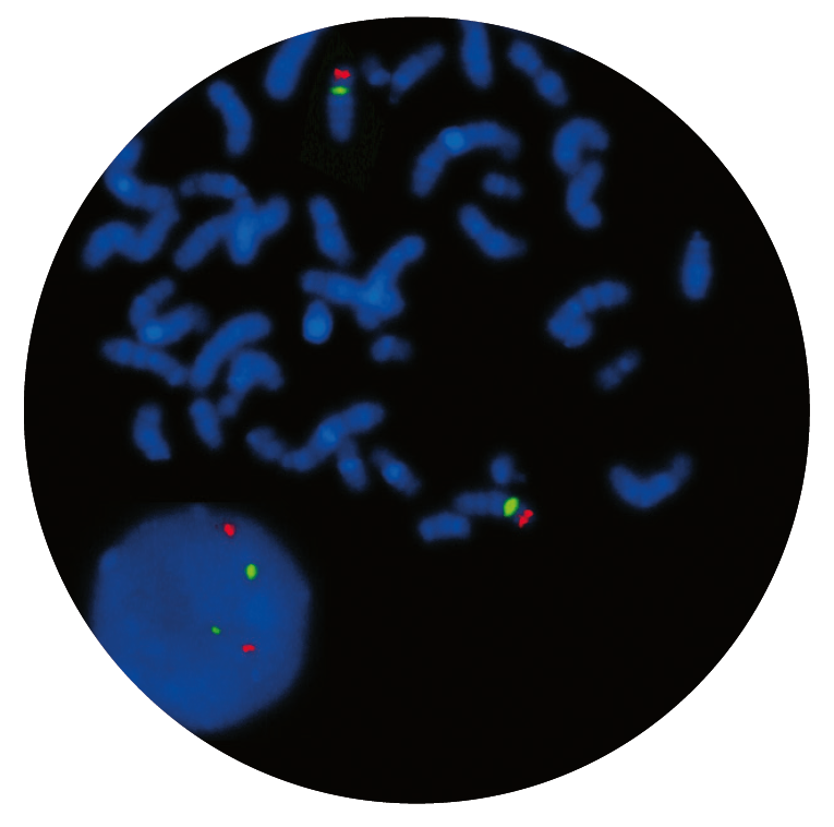 Fluorescence in situ hybridisation (FISH) microscope image of the CytoCell DiGeorge II (10p14) probe.