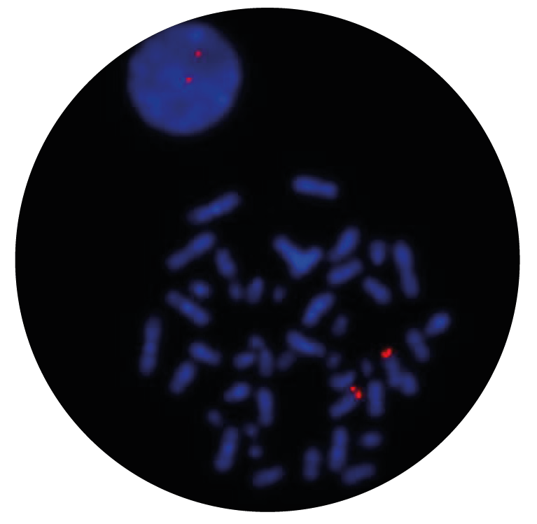 Fluorescence in situ hybridization (FISH) microscope image of the CytoCell NUP214 Probe Red.