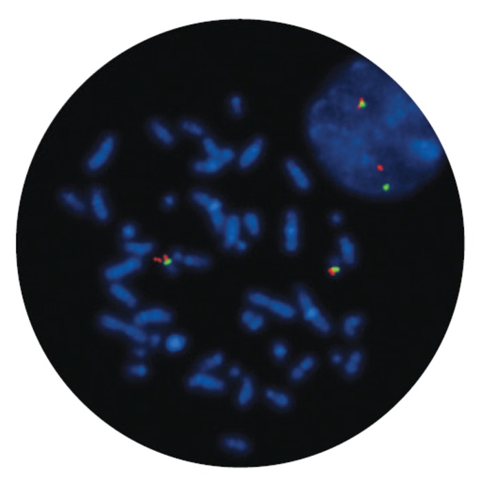 Fluorescence in situ hybridization (FISH) microscope image of the FDA-cleared CytoCell P53 (TP53) Deletion probe.