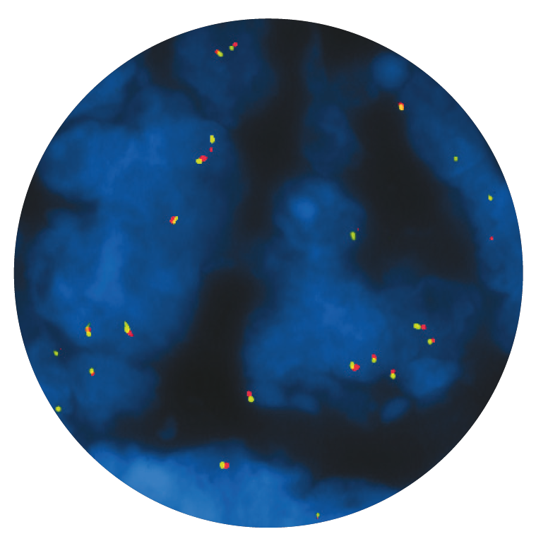Fluorescence in situ hybridization (FISH) microscope image of the CytoCell PAX7 Breakapart probe.