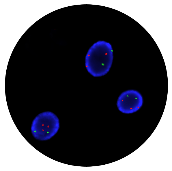 Fluorescence in situ hybridisation (FISH) microscope image of the CytoCell FAST FISH Prenatal X, Y, 13, 18 and 21 probe.