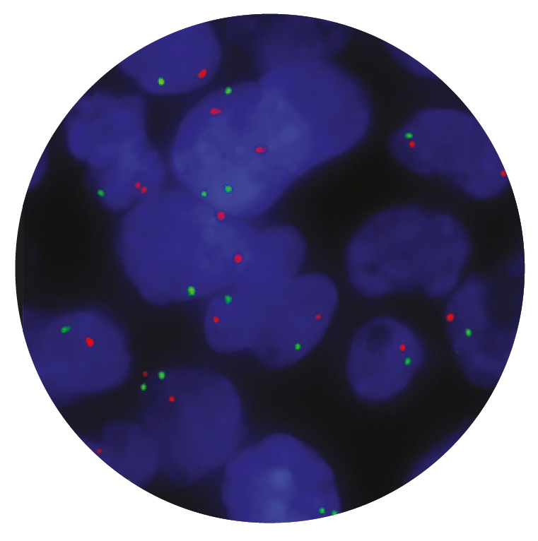 Fluorescence in situ hybridisation (FISH) microscope image of the CytoCell N-MYC (MYCN) Amplification probe.