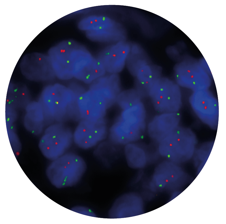 Fluorescence in situ hybridisation (FISH) microscope image of the CytoCell P16 (CDKN2A) Deletion probe.