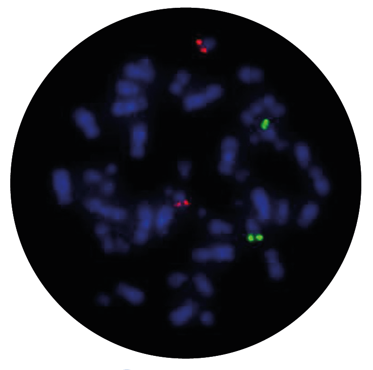 Fluorescence in situ hybridisation (FISH) microscope image of the CytoCell IGH/BCL2 Plus Translocation, Dual Fusion probe.