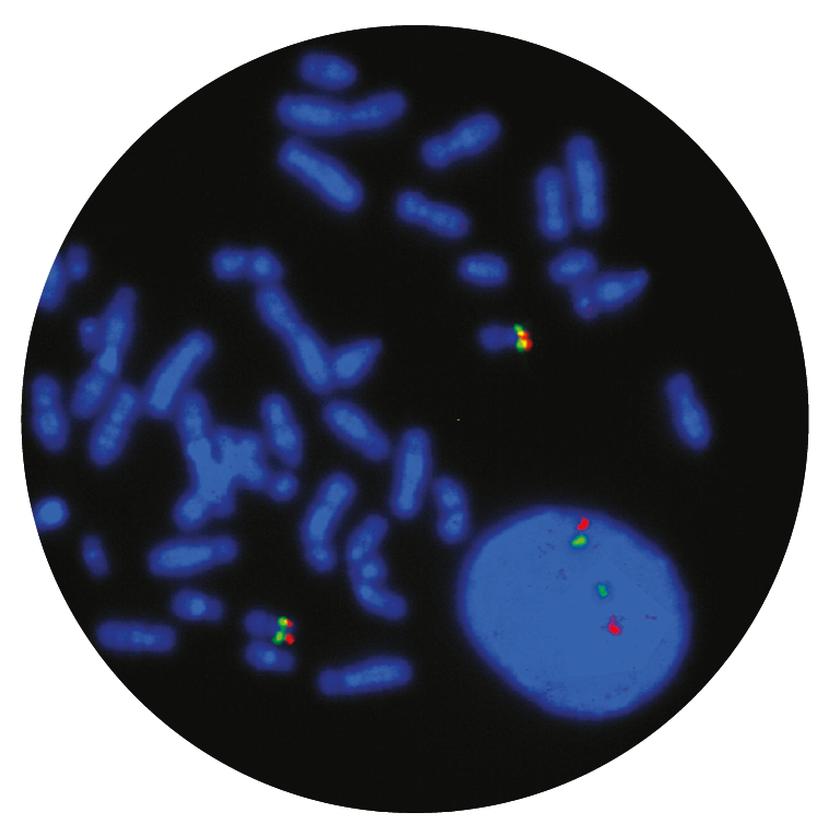 Fluorescence in situ hybridisation (FISH) microscope image of the CytoCell Smith-Magenis (RAI1)/Miller-Dieker probe.