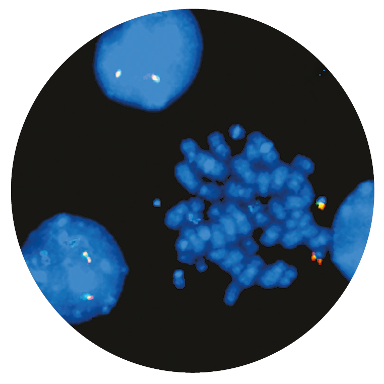 Fluorescence in situ hybridisation (FISH) microscope image of the CytoCell AML1 (RUNX1) Breakapart probe.