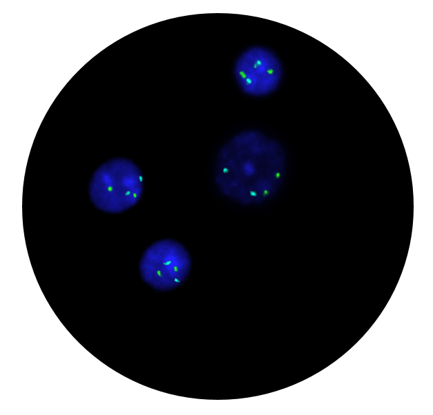Fluorescence in situ hybridisation (FISH) microscope image of the CytoCell Prenatal X, Y and 18 probe.
