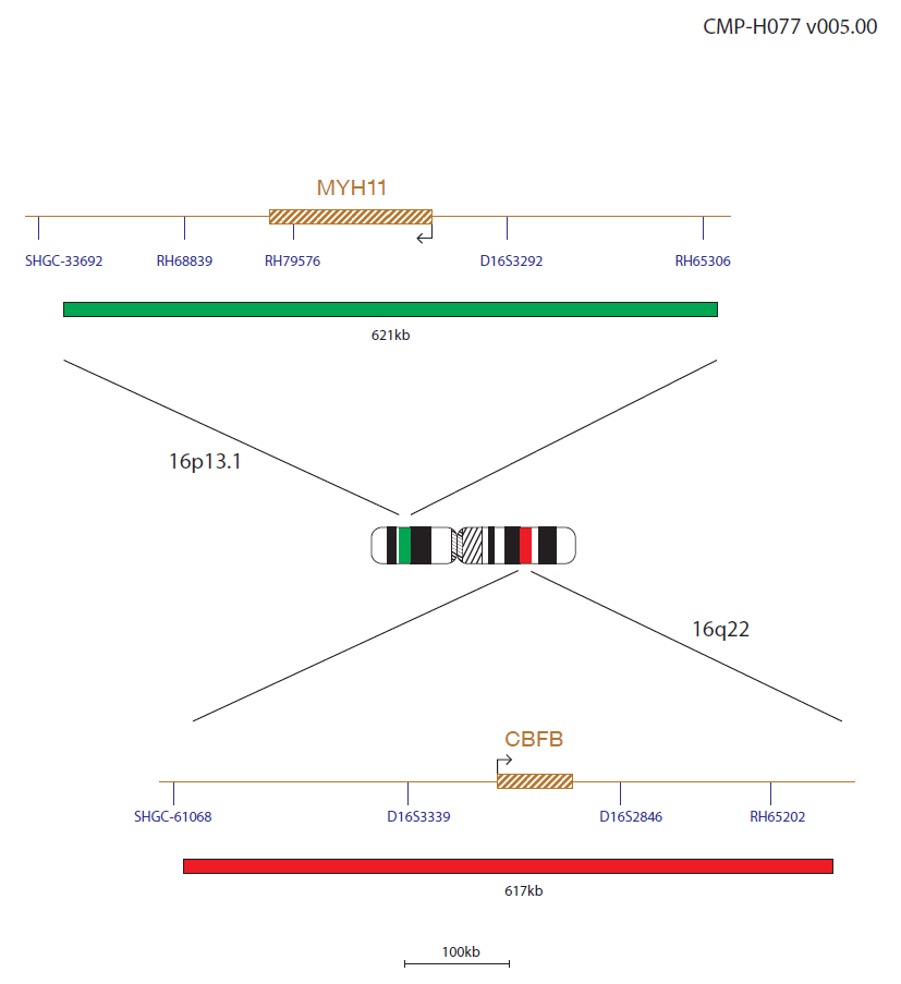 Fluorescence in situ hybridisation (FISH) chromosome map showing a probe targeting the CBFß (CBFB) and MYH11 genes.