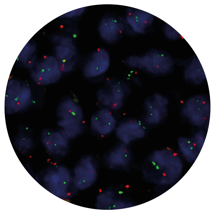 Fluorescence in situ hybridization (FISH) microscope image of the CytoCell IGH/MALT1 Translocation, Dual Fusion probe.