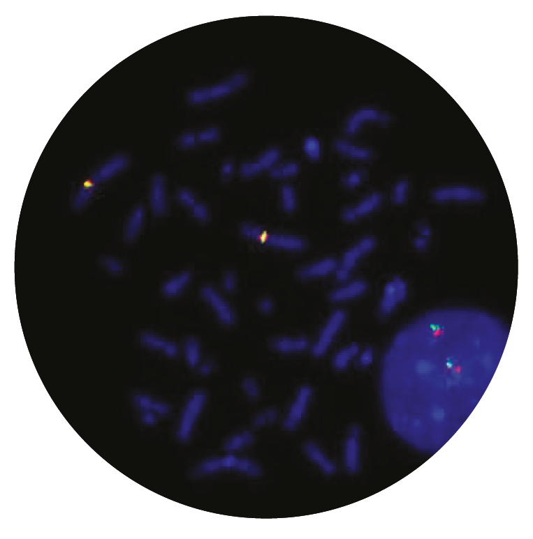 Fluorescence in situ hybridisation (FISH) microscope image of the CytoCell IGK Breakapart probe.