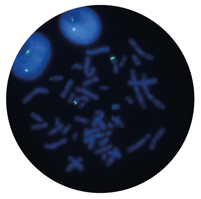 Fluorescence in situ hybridization (FISH) microscope image of the CytoCell MLL (KMT2A) probe.