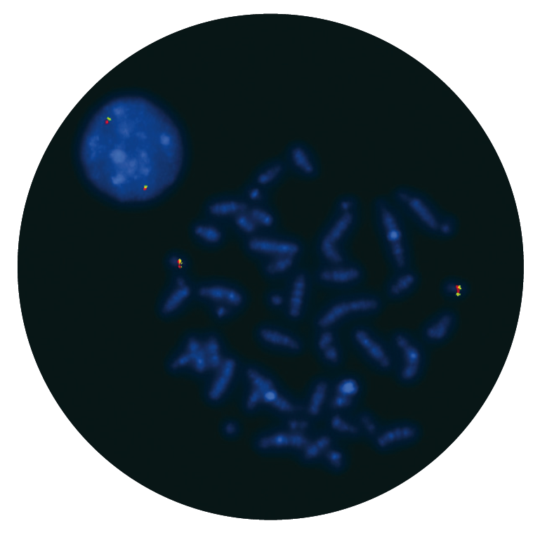 Fluorescence in situ hybridisation (FISH) microscope image of the CytoCell Del(20q) Deletion probe.