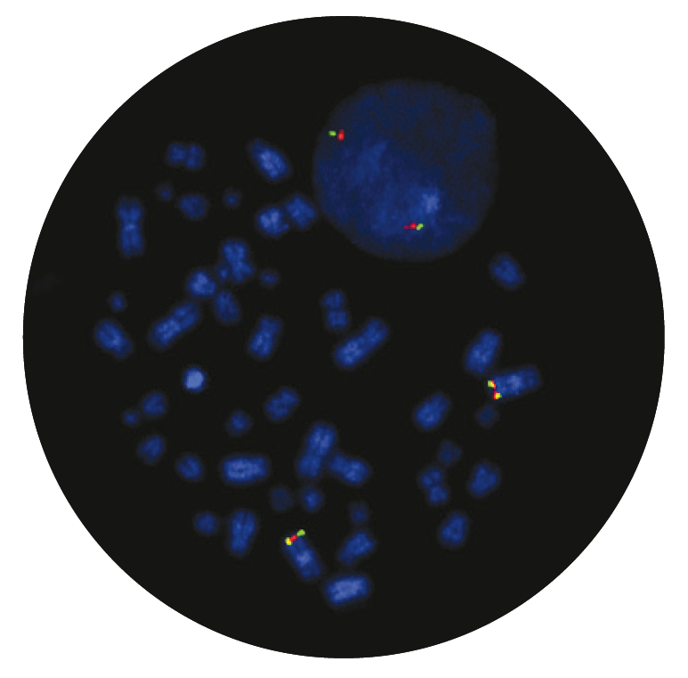 Fluorescence in situ hybridisation (FISH) microscope image of the CytoCell BCL6 Breakapart probe.