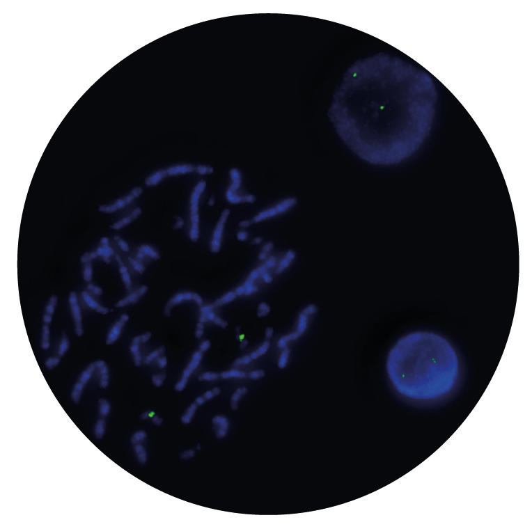 Fluorescence in situ hybridization (FISH) microscope image of the CytoCell FAST RARα (RARA) probe.