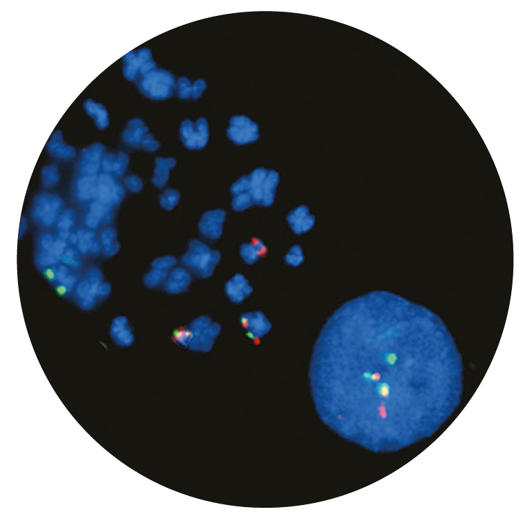 Fluorescence in situ hybridization (FISH) microscope image of the CytoCell BCR/ABL(ABL1) Translocation, Dual Fusion probe.