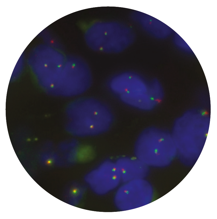 Fluorescence in situ hybridisation (FISH) microscope image of the CytoCell FOXO1 Breakapart probe.