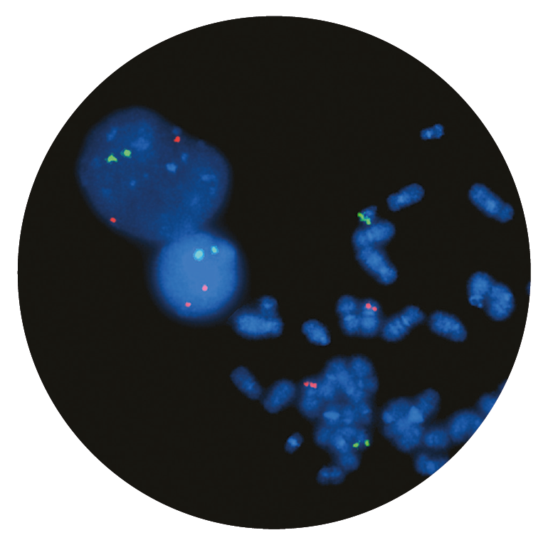 Fluorescence in situ hybridisation (FISH) microscope image of the CytoCell TEL/AML1 Translocation, Dual Fusion probe.