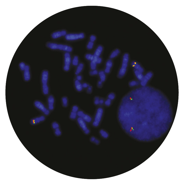 Fluorescence in situ hybridisation (FISH) microscope image of the CytoCell TLX1 Breakapart probe.