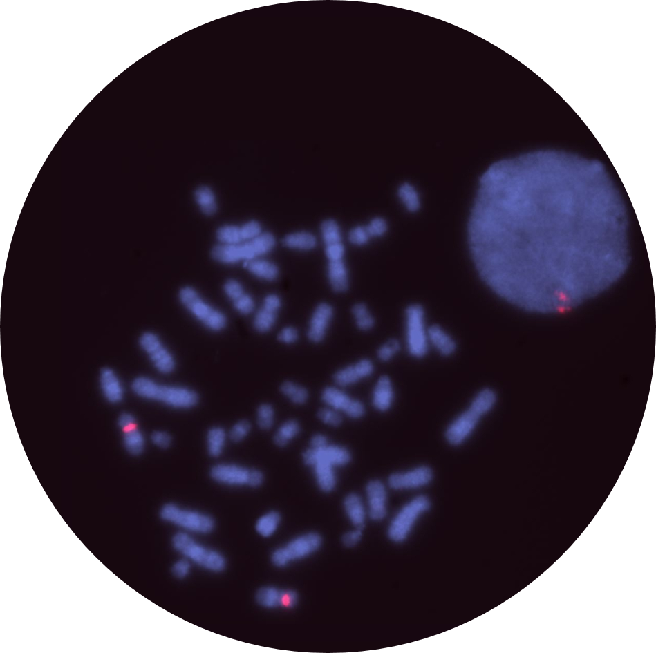 Fluorescence in situ hybridisation (FISH) microscope image of the CytoCell Alpha Satellite 12 Plus for CLL probe.
