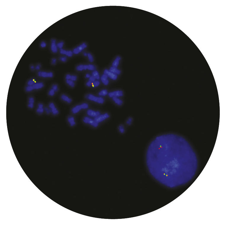 Fluorescence in situ hybridisation (FISH) microscope image of the CytoCell TCL1 Breakapart probe.