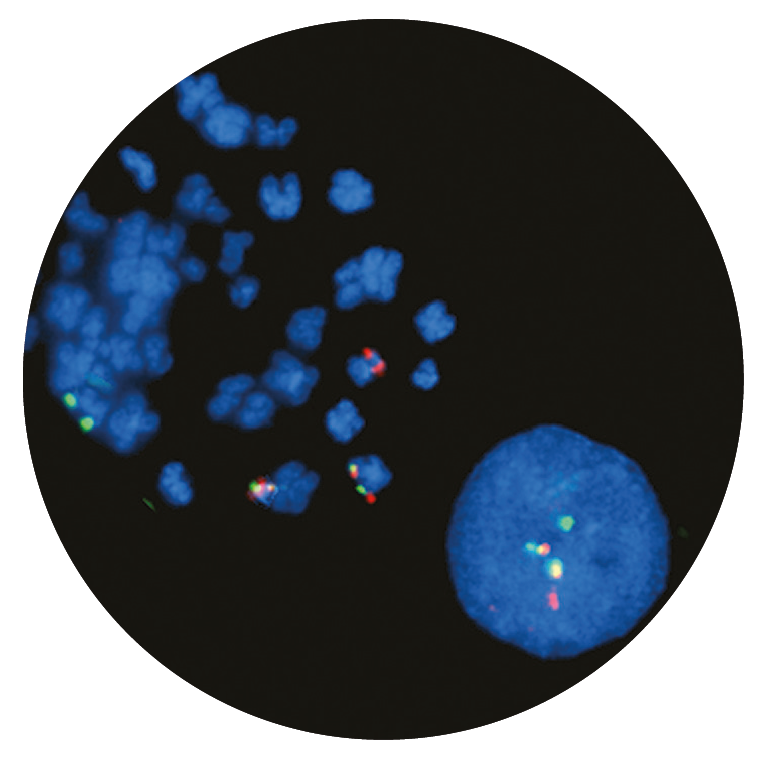 Fluorescence in situ hybridisation (FISH) microscope image of the CytoCell BCR/ABL (ABL1) Translocation, Dual Fusion probe.