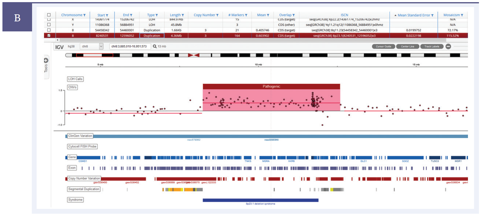 Next generation sequencing (NGS) software data showing a 4.36Mb duplication detected on chromosome 8.