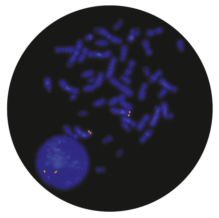 Fluorescence in situ hybridisation (FISH) microscope image of the CytoCell TLX3 Breakapart probe.