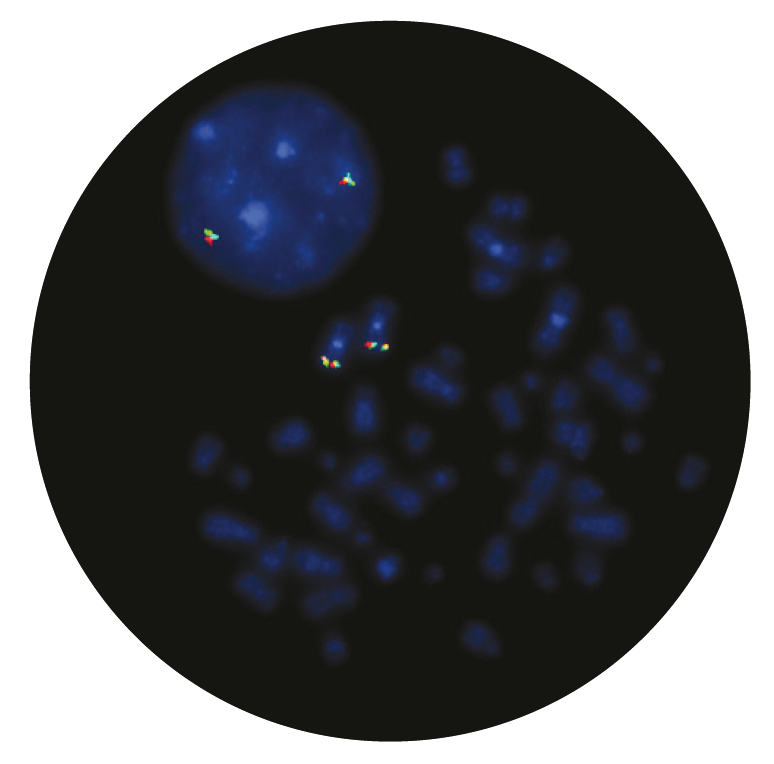 Fluorescence in situ hybridization (FISH) microscope image of the CytoCell EVI1 (MECOM) Breakapart probe.