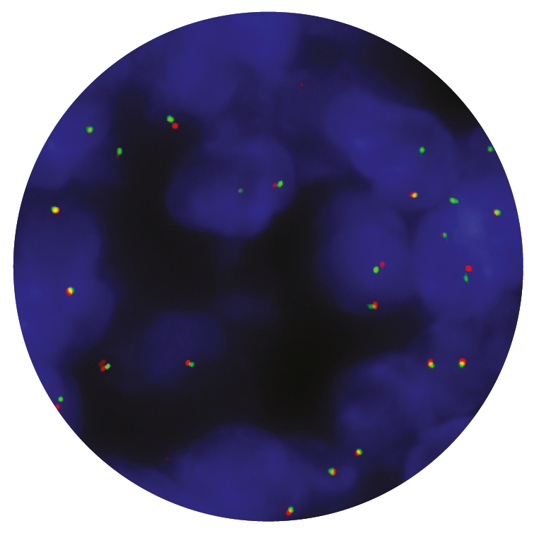 Fluorescence in situ hybridisation (FISH) microscope image of the CytoCell CHOP (DDIT3) Breakapart probe.