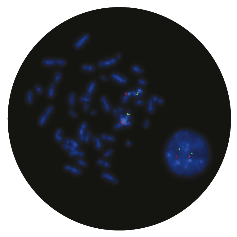Fluorescence in situ hybridisation (FISH) microscope image of the CytoCell CKS1B/CDKN2C (P18) Amplification/Deletion probe.