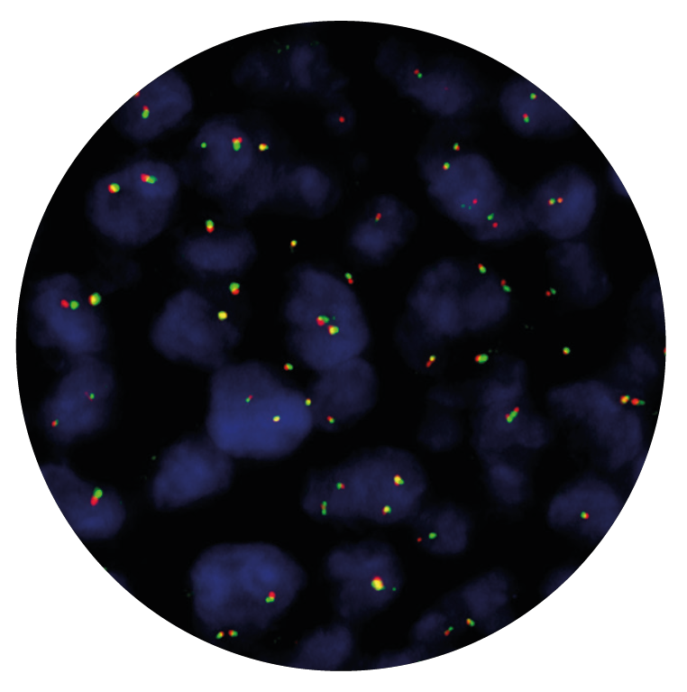 Fluorescence in situ hybridization (FISH) microscope image of the CytoCell IGH Breakapart probe.
