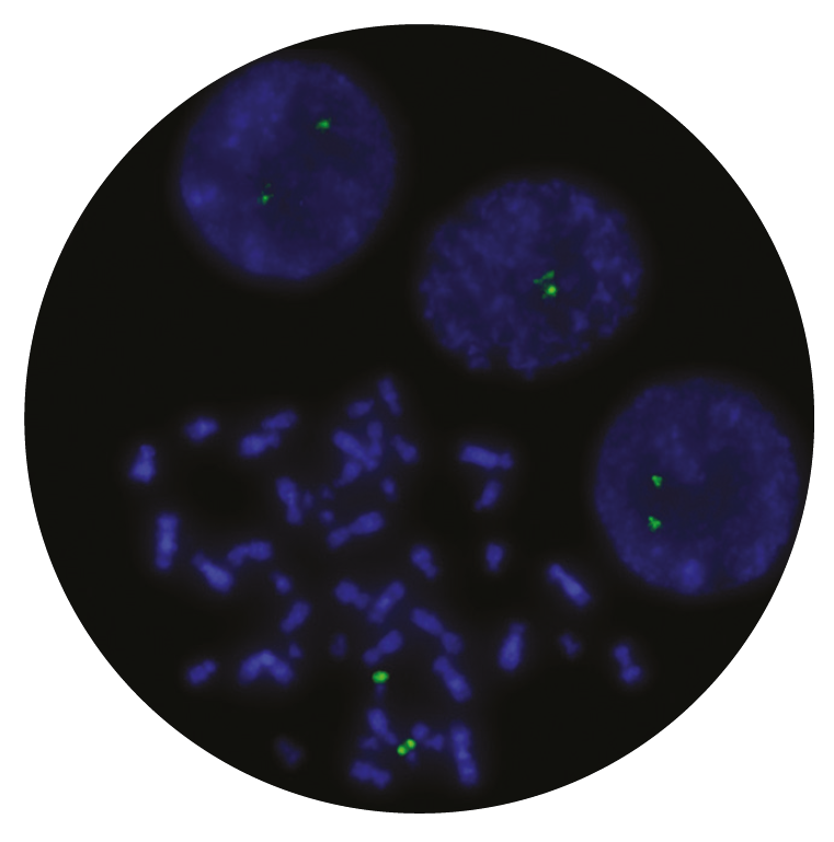 Fluorescence in situ hybridization (FISH) microscope image of the CytoCell E2A (TCF3) probe.