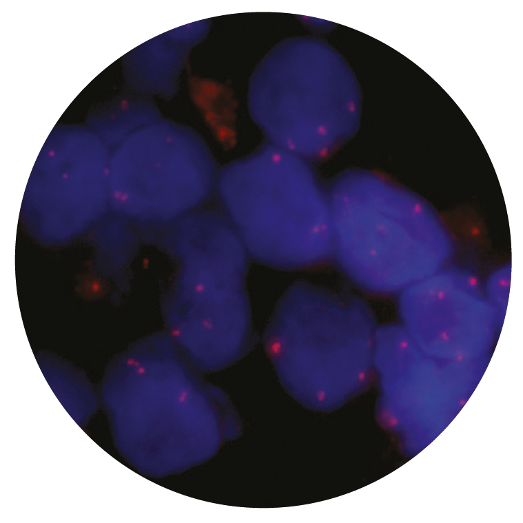 Fluorescence in situ hybridization (FISH) microscope image of the CytoCell FOXO1 Distal Probe Red.